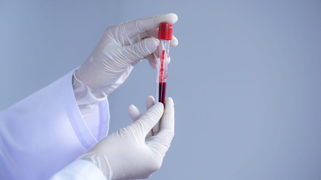 Golden blood is the rarest blood type.