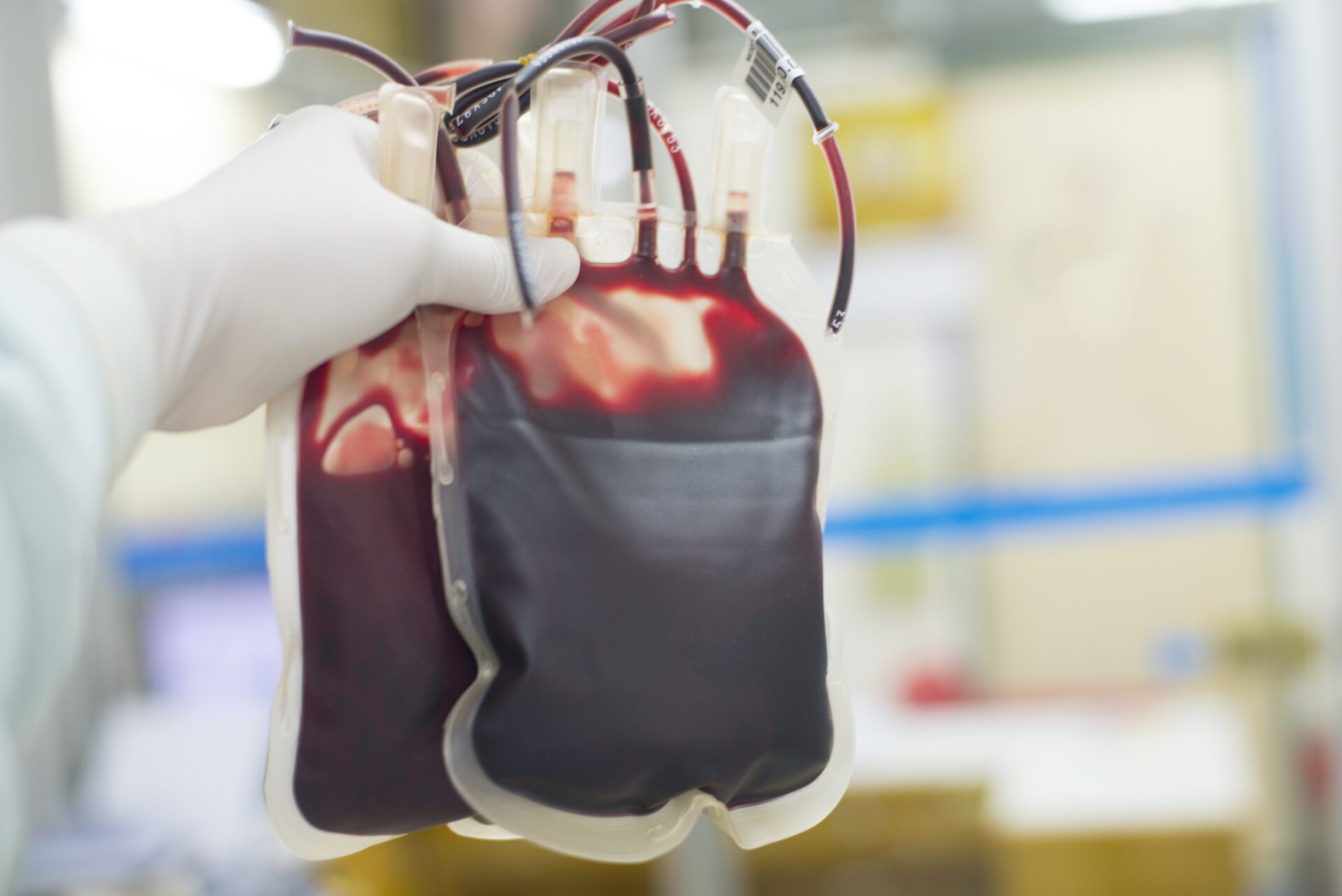 People with Rh-0 blood type have a problem with blood transfusions.