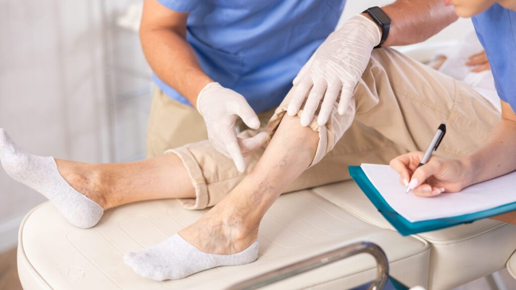Are you suffering from varicose veins? Is there a fruit that can help more than creams
