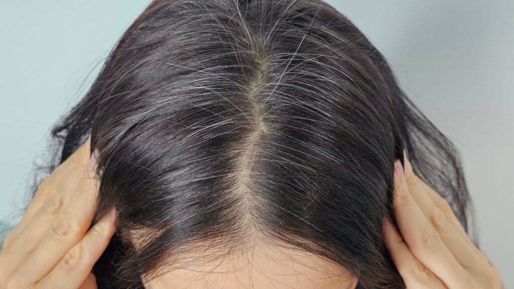 Grey hair can start to bother you at a young age. It is therefore a good idea to follow prevention and protect yourself against them.