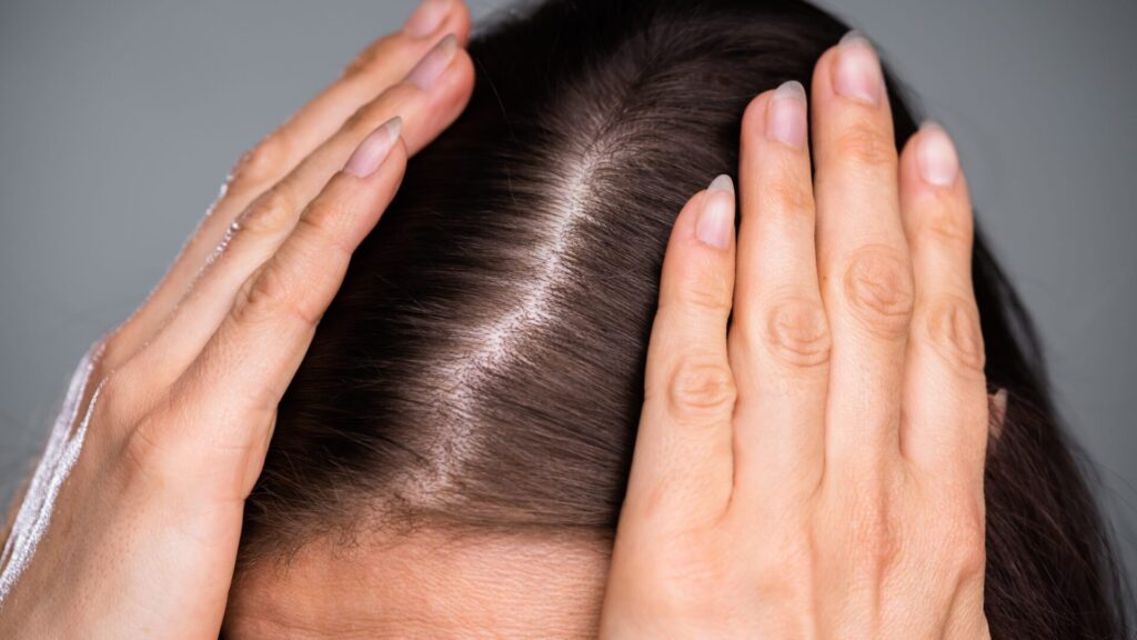 Thinning hair can be a problem. But if you know what hairstyle to do on your head, you can cover up the flaws very easily.