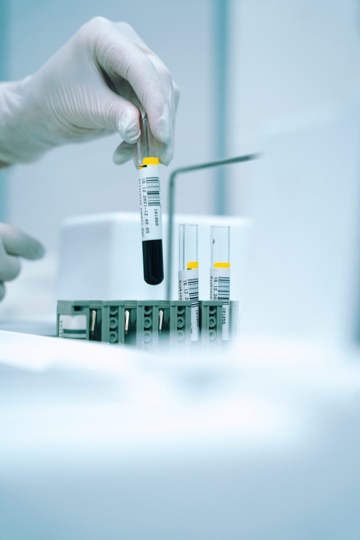 In sepsis, antibiotics should be given immediately and the patient's condition should be monitored. And thanks to blood tests, this is possible in some cases.